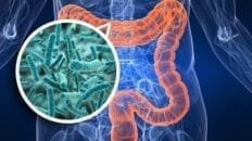 Flora Intestinal1