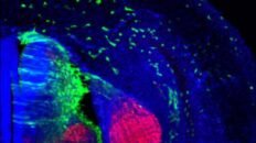 puede la contaminacion del aire causar alzheimer