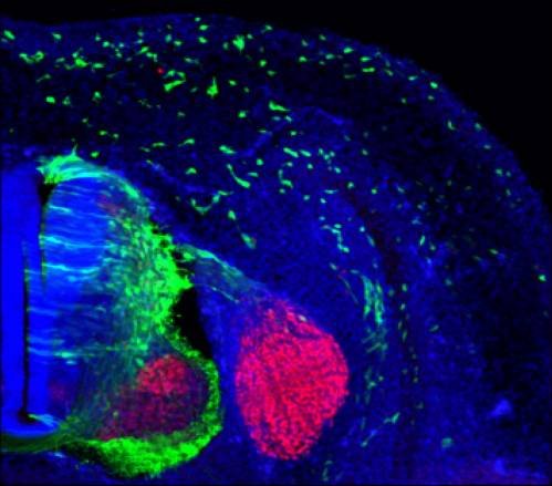puede la contaminacion del aire causar alzheimer