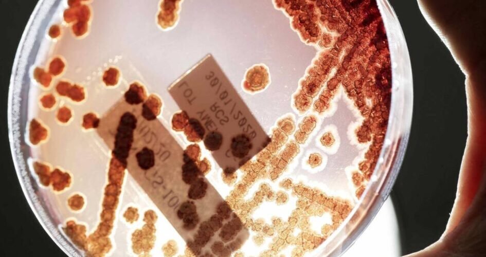 como frenar las resistencias antibacterianas sin crear nuevos antibioticos