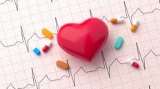 que es la fibrilacion auricular sintomas riesgos y su impacto en la salud global