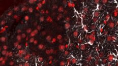 una linterna molecular detecta metastasis cerebral en ratones con una sonda de luz ultrafina