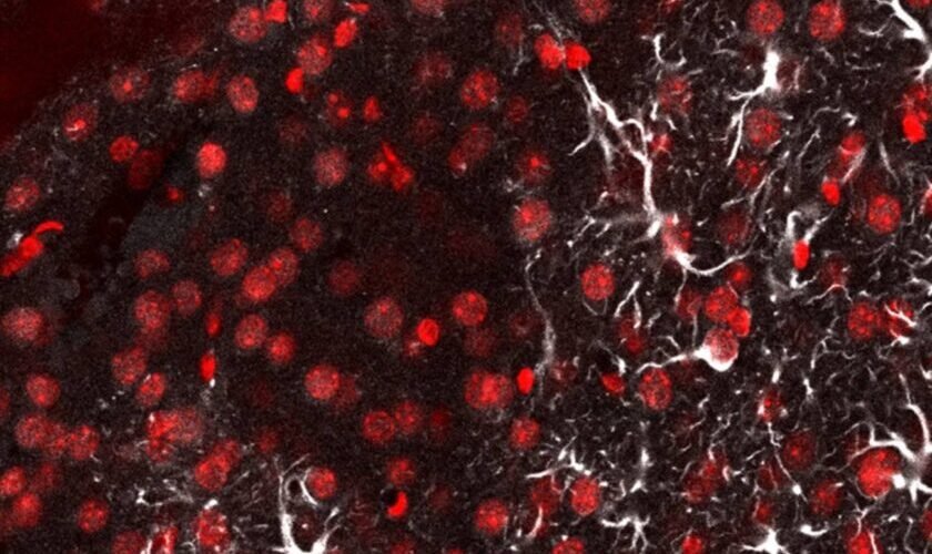 una linterna molecular detecta metastasis cerebral en ratones con una sonda de luz ultrafina