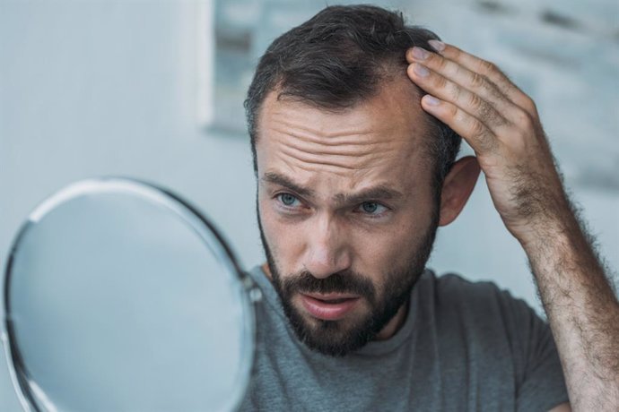esto es lo que tienes que hacer si empiezas a notar que te quedas sin pelo