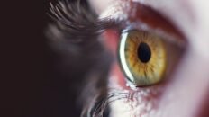 un simple examen ocular pude predecir tu riesgo de accidente cerebrovascular