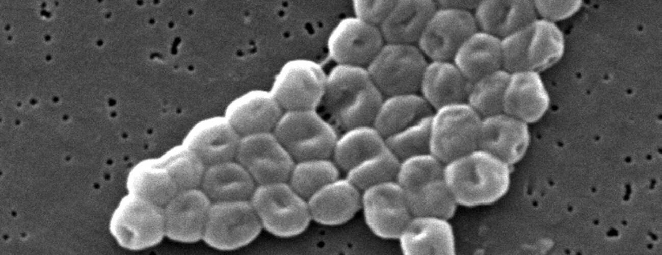 la batalla entre dos virus en una bacteria abre nuevas vias contra la resistencia a antibioticos