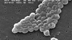 la batalla entre dos virus en una bacteria abre nuevas vias contra la resistencia a antibioticos