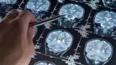 descubren un mecanismo que permite a las celulas especializadas de las meninges mantener la salud cerebral