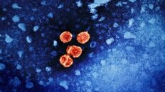 esperanza para la hepatitis b investigacion identifica posible diana terapeutica