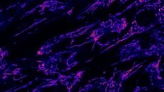 un defecto en el transporte de grasas revela la causa de las raras crisis metabolicas infantiles