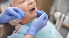 40 anos de implantes dentales por que resisten el paso del tiempo pero las coronas no tanto