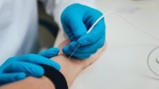 es dolorosa la electromiografia todo lo que debes saber sobre este procedimiento