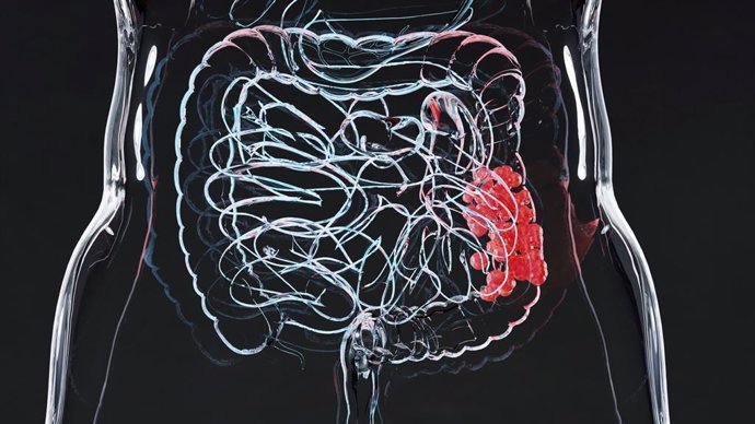 cancer colorrectal metastasico como los inhibidores de inmunoterapia mejoran la supervivencia
