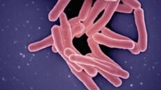 los casos de tuberculosis infantil aumentan un 26 en la union europea