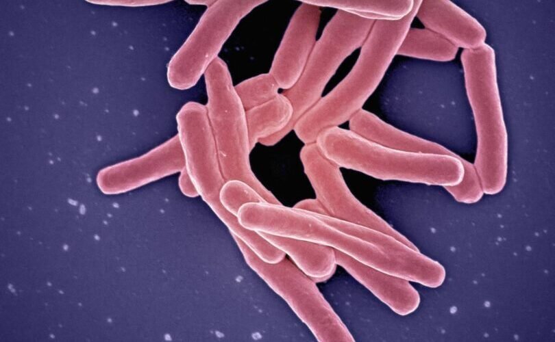 los casos de tuberculosis infantil aumentan un 26 en la union europea