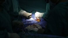 trasplantan por primera vez un higado de cerdo a una persona en muerte cerebral