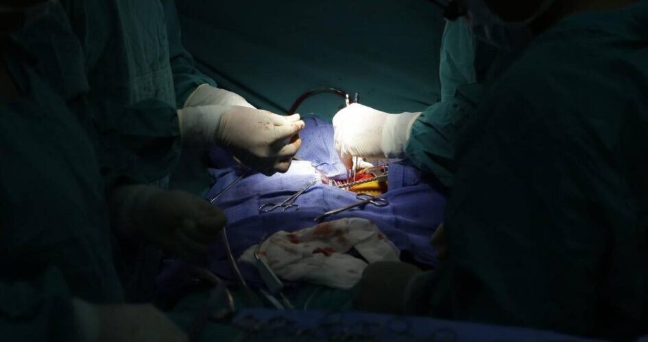 trasplantan por primera vez un higado de cerdo a una persona en muerte cerebral