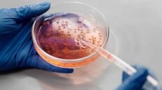 asi logra ocultarse el cancer de piel y resistir a la inmunoterapia