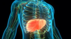 la enfermedad hepatica por alcohol se diagnostica en fases mas avanzadas de fibrosis que enfermedades por higado graso