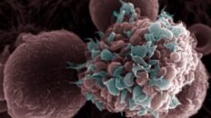 una dieta alta en grasas favorece la metastasis del cancer de mama en ratones