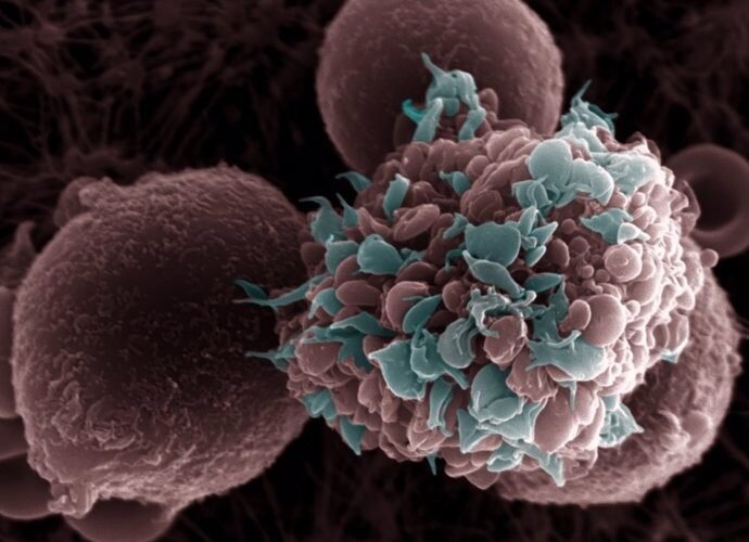 una dieta alta en grasas favorece la metastasis del cancer de mama en ratones