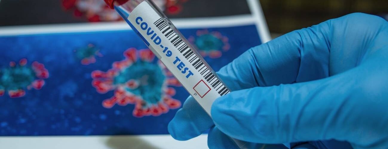 descubren fallos en las secuencias geneticas del coronavirus en la mayor base de datos mundial