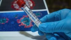 descubren fallos en las secuencias geneticas del coronavirus en la mayor base de datos mundial