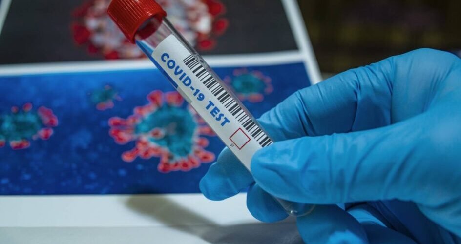 descubren fallos en las secuencias geneticas del coronavirus en la mayor base de datos mundial