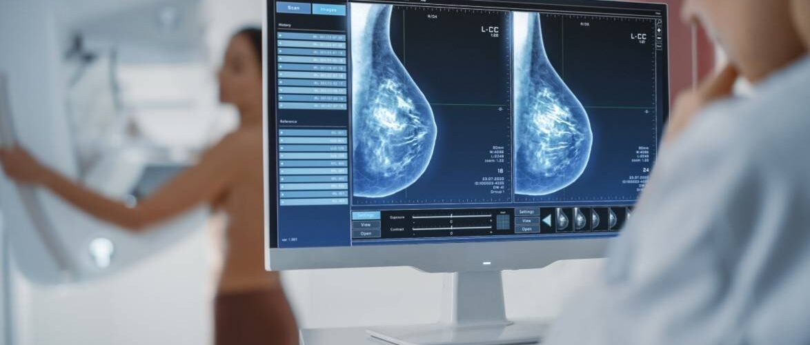 las dietas grasientas favorecen la metastasis del cancer de mama en ratonas