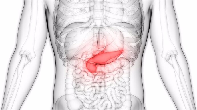 un farmaco experimental frena el cancer de pancreas avanzado y reduce metastasis en pacientes