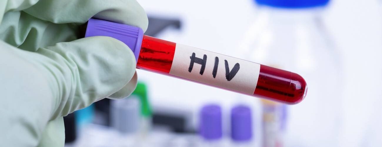 no podemos permitir que el control de la infeccion del vih vuelva a retroceder 20 anos