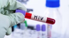 no podemos permitir que el control de la infeccion del vih vuelva a retroceder 20 anos