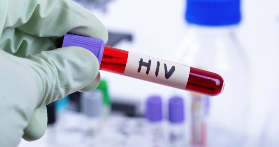 no podemos permitir que el control de la infeccion del vih vuelva a retroceder 20 anos