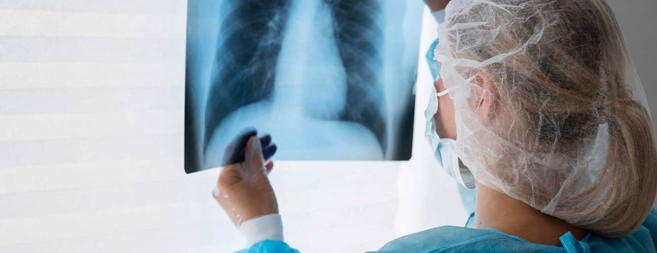 identifican una nueva diana terapeutica para el cancer de pulmon
