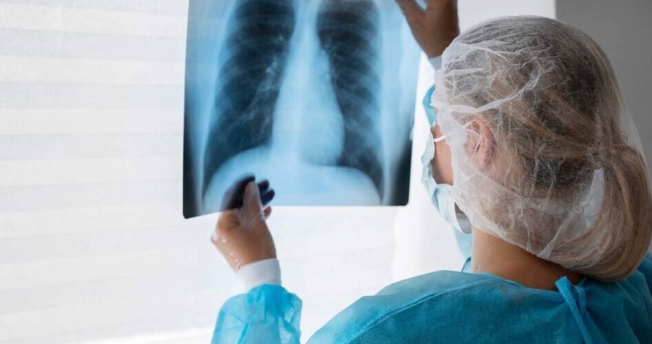 identifican una nueva diana terapeutica para el cancer de pulmon