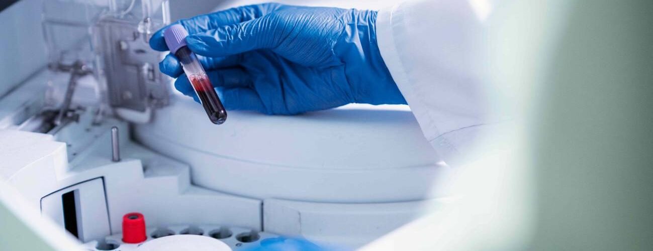 la gepotidacina nuevo farmaco seguro y eficaz para la gonorrea