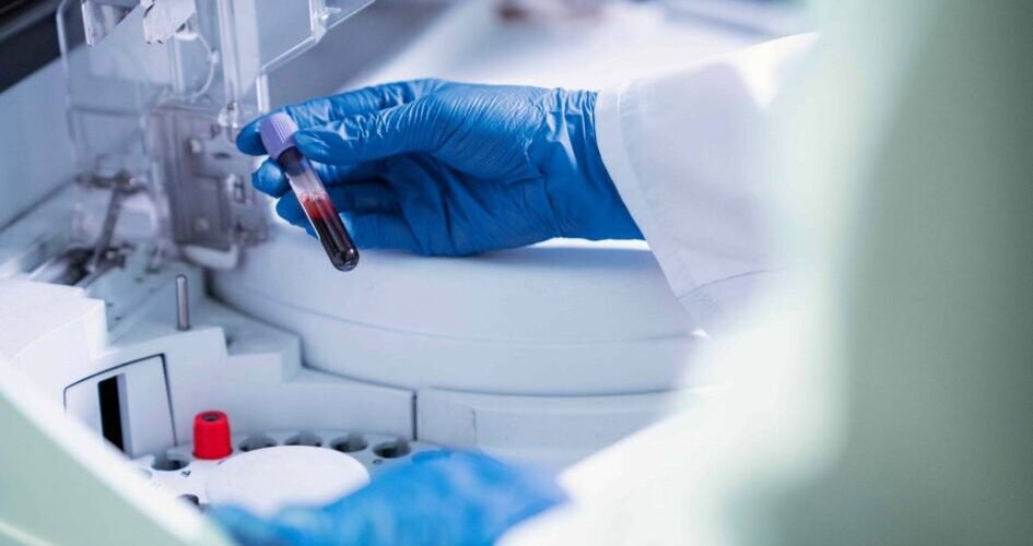 la gepotidacina nuevo farmaco seguro y eficaz para la gonorrea