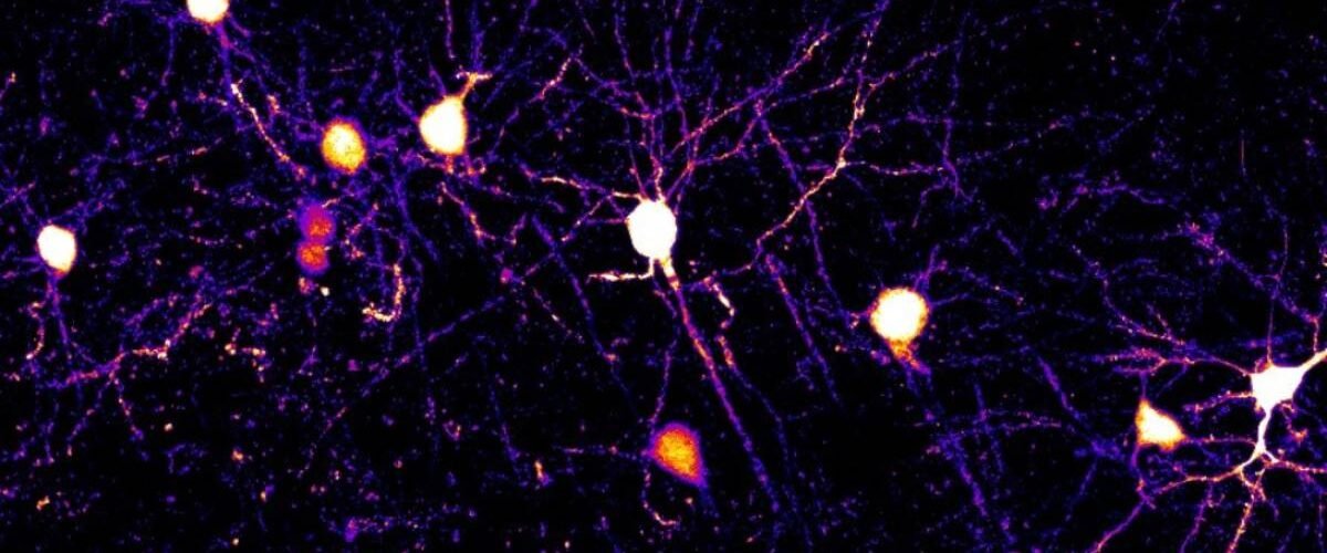 descubren como nuestro cerebro aprende las neuronas usan multiples reglas a la vez