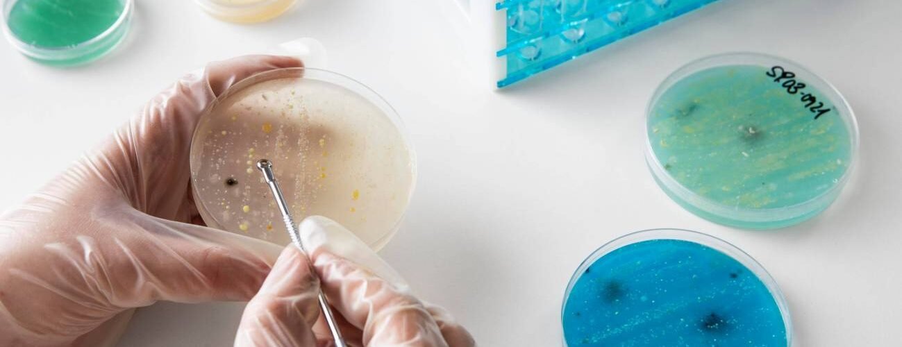 asocian el aumento del cancer de colon en jovenes con una infeccion bacteriana en la infancia