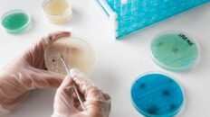 asocian el aumento del cancer de colon en jovenes con una infeccion bacteriana en la infancia