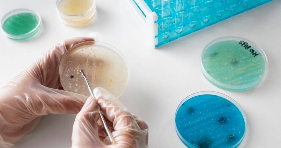 asocian el aumento del cancer de colon en jovenes con una infeccion bacteriana en la infancia