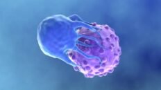 sanidad amplia la cobertura de las terapias car t contra el cancer para personas con vih
