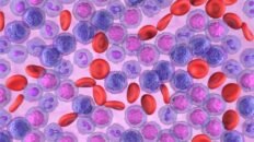 una prueba de medula osea podria duplicar la supervivencia en jovenes con leucemia agresiva