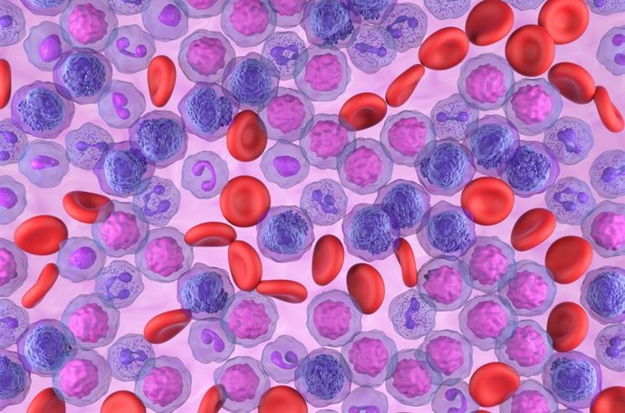 una prueba de medula osea podria duplicar la supervivencia en jovenes con leucemia agresiva