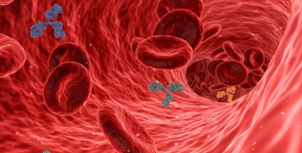 una nueva prueba del colesterol malo previene con mas precision enfermedades coronarias