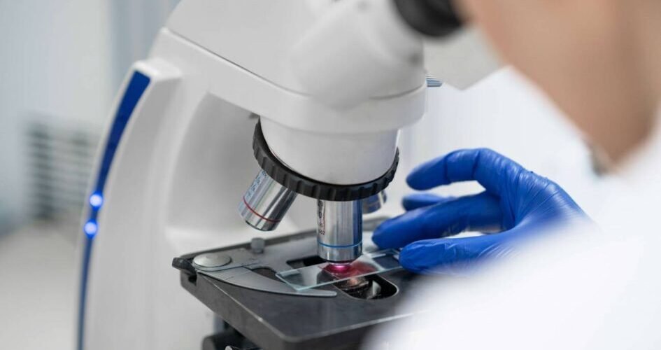 la falta de una proteina inicia el cancer de colon en ratones