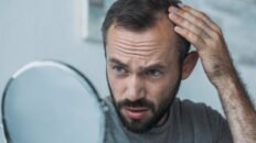 confirman que un tratamiento usado para combatir la alopecia puede inducir pensamientos suicidas