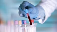 que deben incluir y que ahora no llevan tus proximos analisis de sangre rutinarios