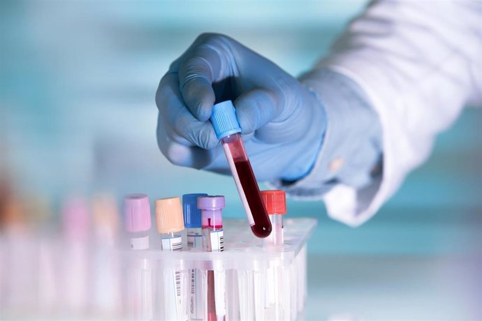 que deben incluir y que ahora no llevan tus proximos analisis de sangre rutinarios