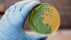 las infecciones por escherichia coli y listeria alcanzan maximos historicos en la ue